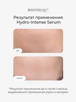 Сыворотка интенсивная увлажняющая с гиалуроновой кислотой | BIOHYALUX НА HYDRO INTENSE SERUM 30х1,5 мл