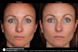 JAN MARINI AGE INTERVENTION RETINOL+ 0,5% Крем-акселератор с ретинолом 0,5% для борьбы с видимыми возрастными изменениями