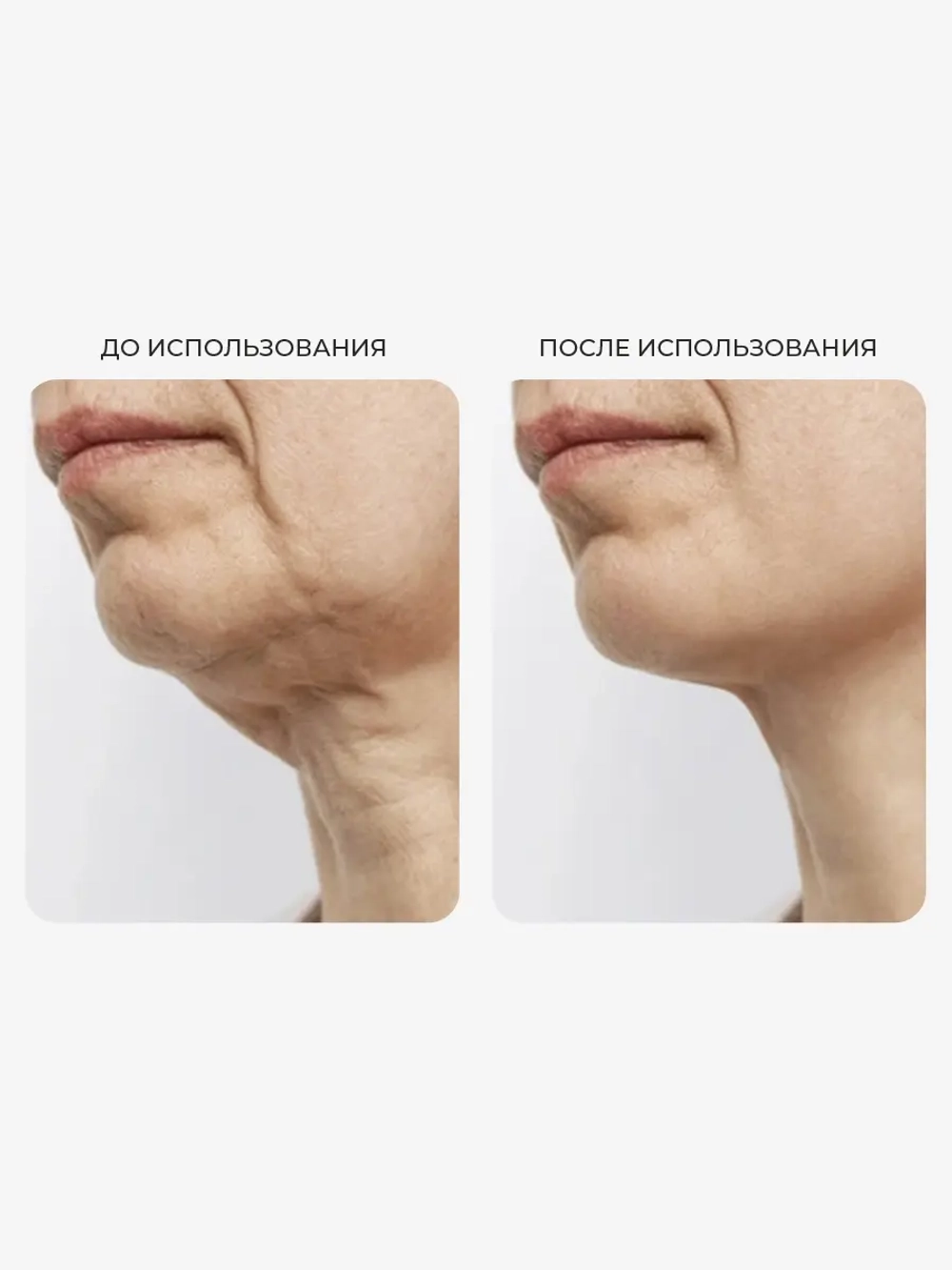 Arocell Эластичная маска для подтяжки и укрепления нижней трети лица Botoki V Mask 18 гр х 4 шт