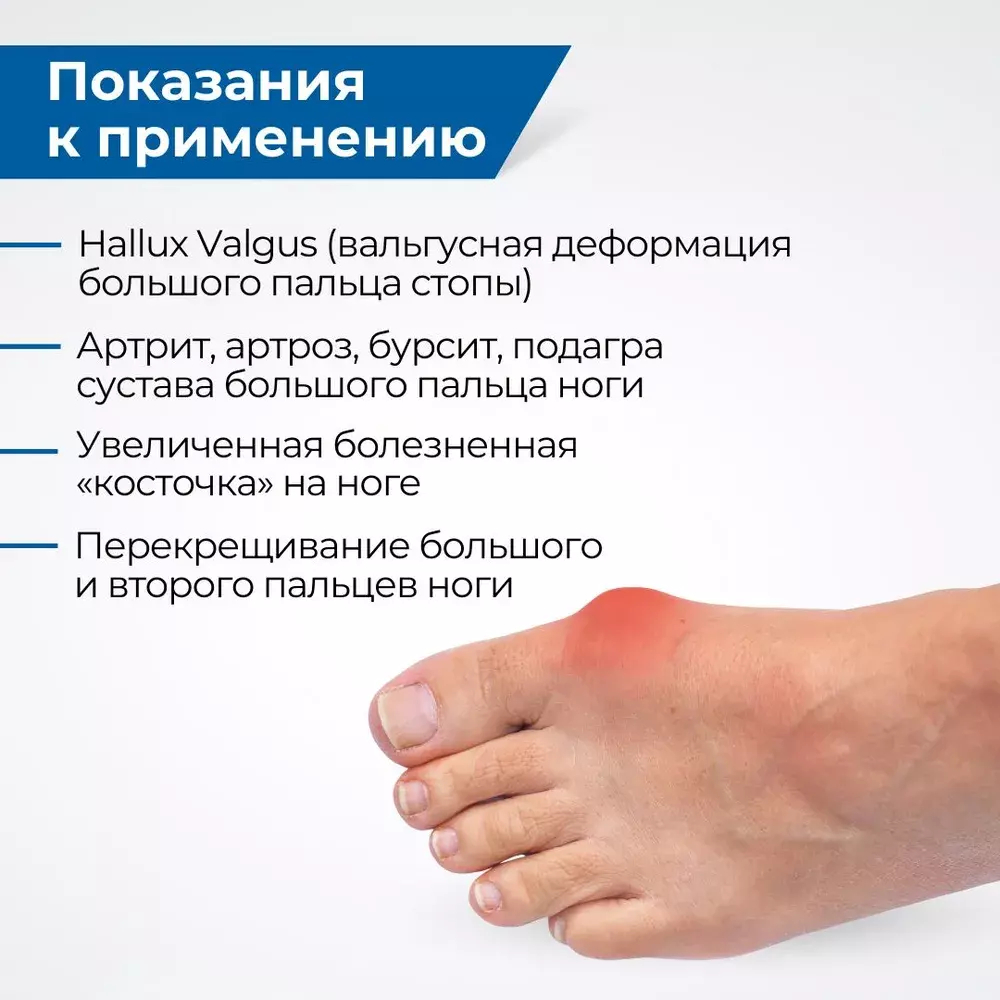 Вальгусная шина для большого пальца ноги, бандаж при косточке с металлическим стержнем