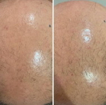 Hair Forest Ampoule Eldermafill | Восстановление волос