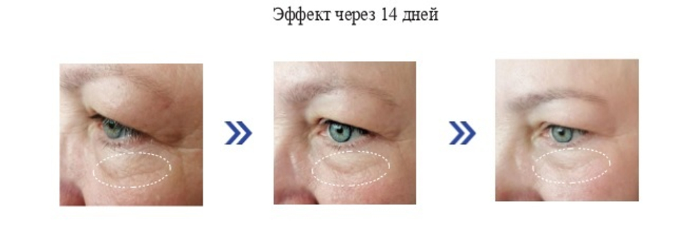 Eye Neuro Lift - Суперлифтиновая сыворотка для периорбитальной области, 15 мл