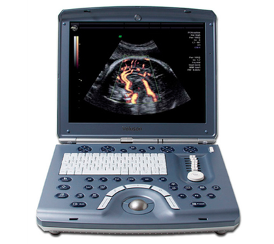 Портативный ультразвуковой аппарат GE Healthcare Voluson E