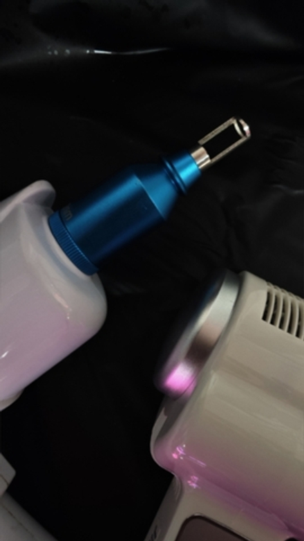 Удаление татуировки