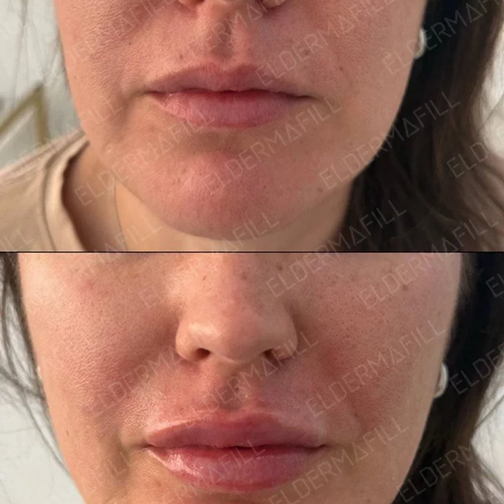 Deep French Kiss Eldermafill