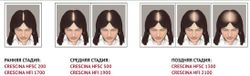 Crescina HFI Hair Follicular Islands 1700 Лосьон для стимуляции роста волос, для женщин (40 ампул по 3,5 мл)