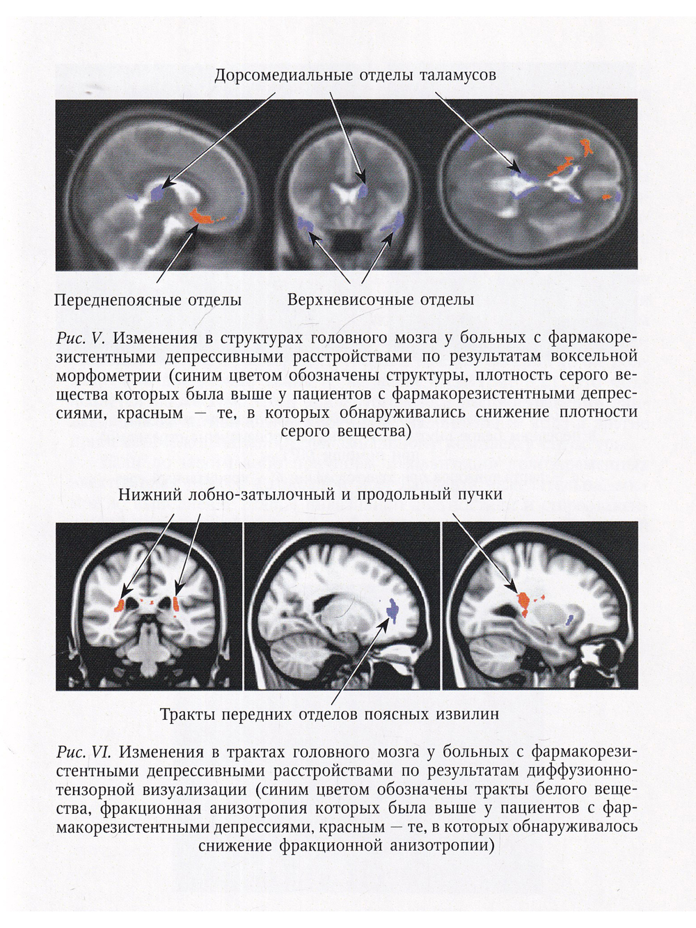 Функциональная нейрохирургия в лечении нервных и психических заболеваний