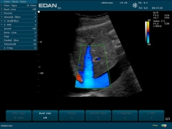 Аппарат УЗИ Edan U2 (без УЗИ датчиков)