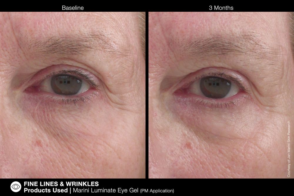 JAN MARINI LUMINATE EYE GEL Концентрированная сыворотка для кожи вокруг глаз с эффектом сияния против темных кругов и морщин