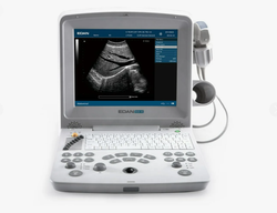 Аппарат УЗИ Edan DUS 60 (без УЗИ датчиков)