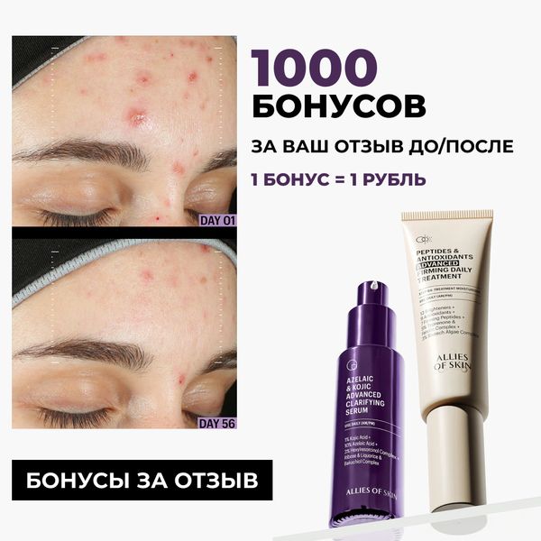 Дарим 1000 бонусов за ваш отзыв ДО/ПОСЛЕ