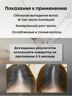 Сыворотка для роста волос