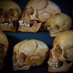 Набор «Череп человека» (анатомические модели)