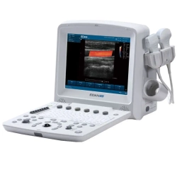 Аппарат УЗИ Edan DUS 60 (стандартный)