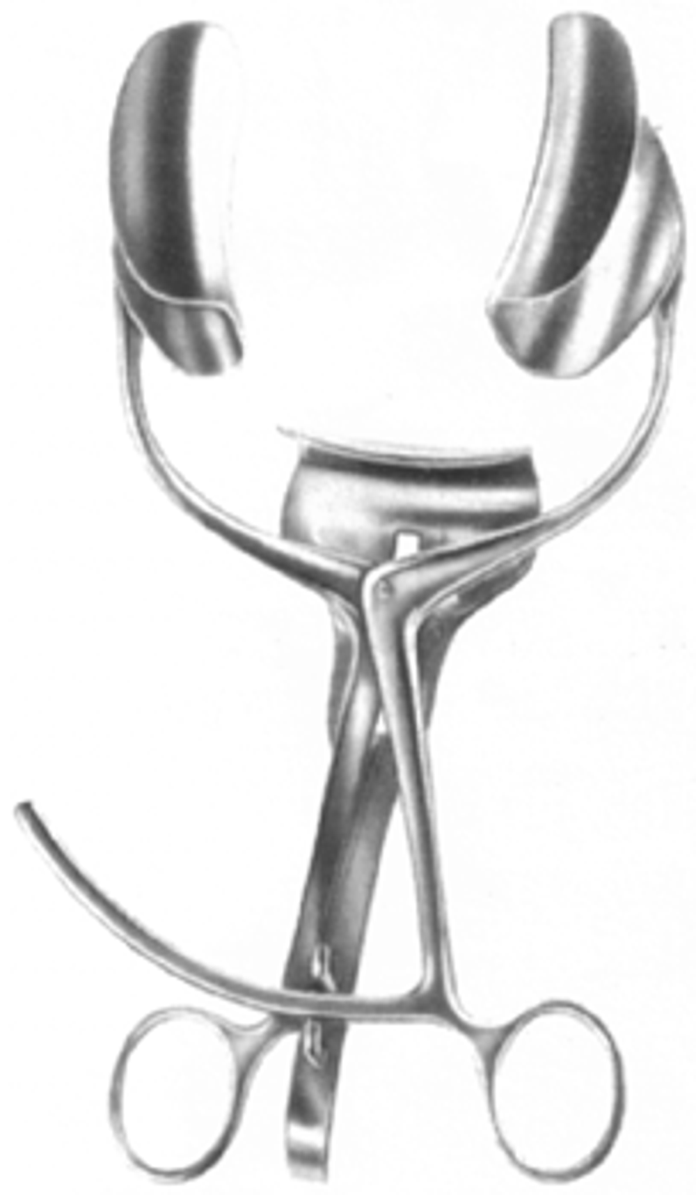 ВР- Р-48 Ранорасширитель с кремальерой 3-х створчатый 150мм