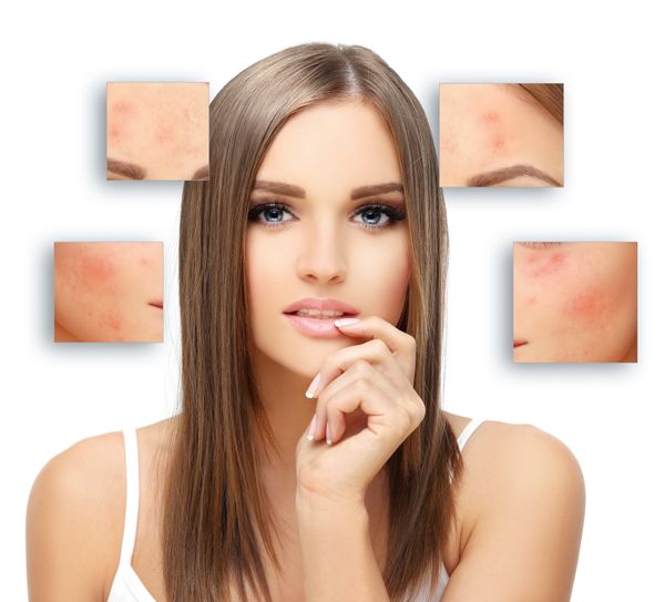 Age spots: causes and how to deal with them