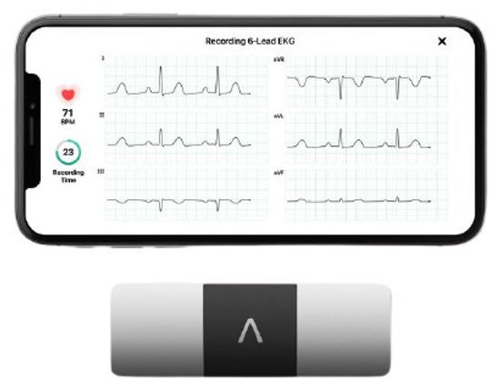 Портативный электрокардиограф AliveCor KardiaMobile 6L