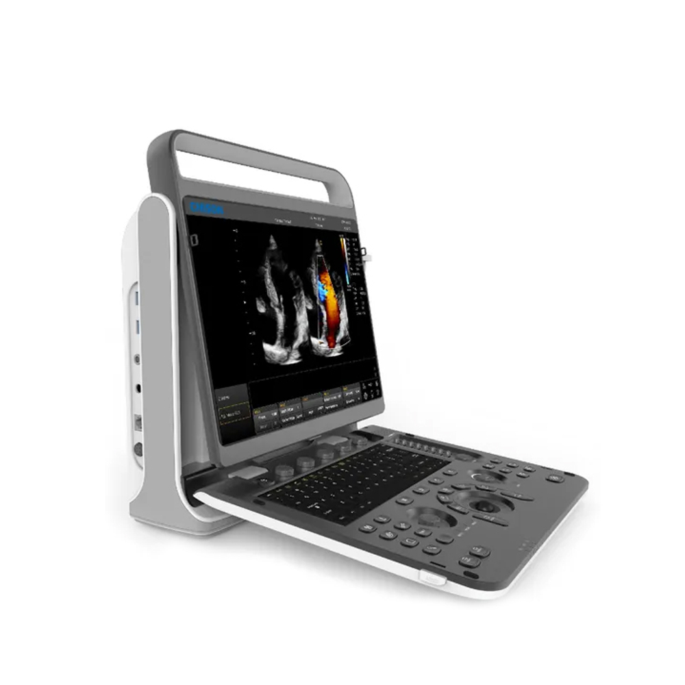 Ультразвуковой аппарат Chison SonoTouch 60 Pro