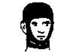 Заказ компрессионной одежды для лечения рубцов после ожогов