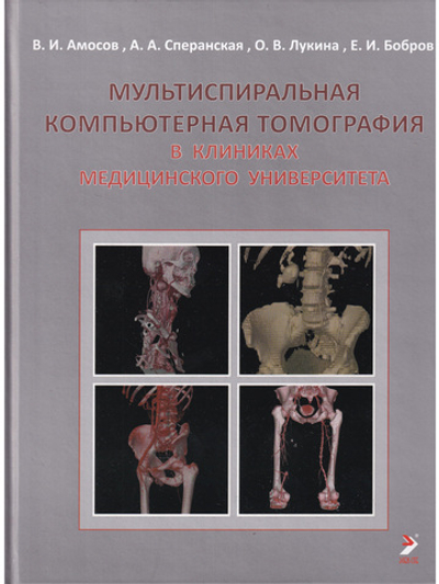 Мультиспиральная компьютерная томография в клиниках медицинского университета