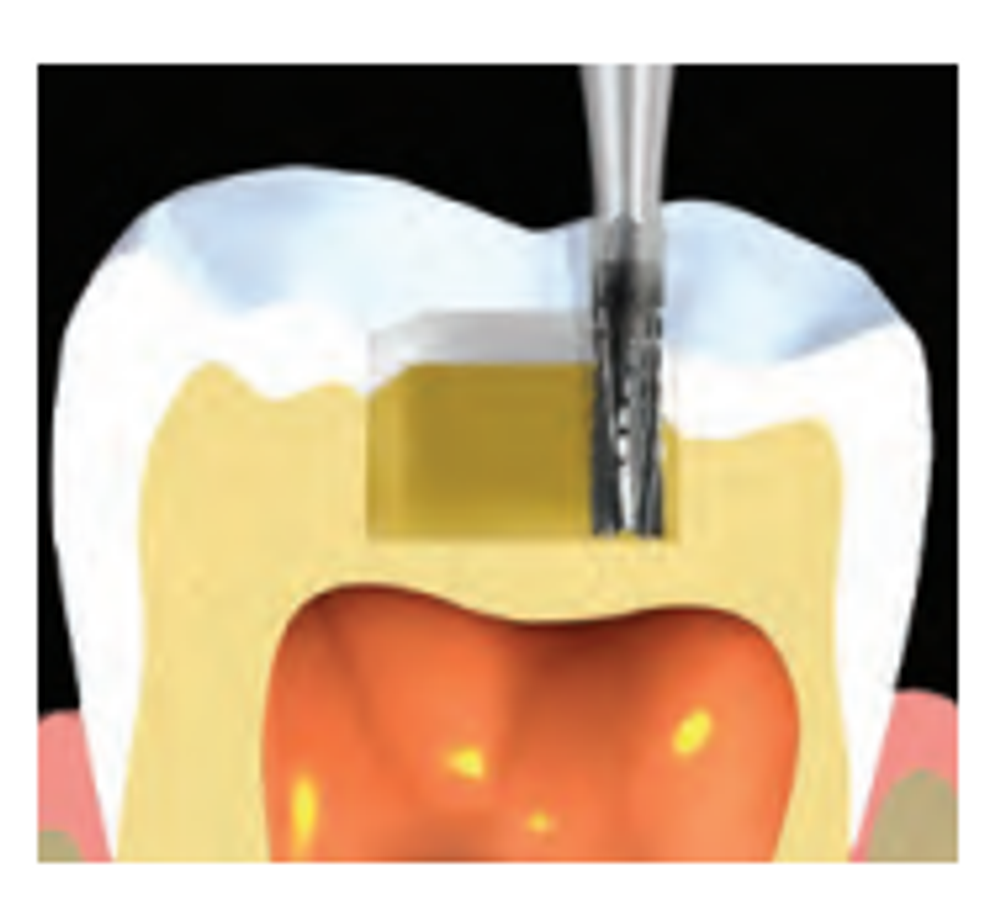 Бор твердосплавный Midwest - 227 LA 700