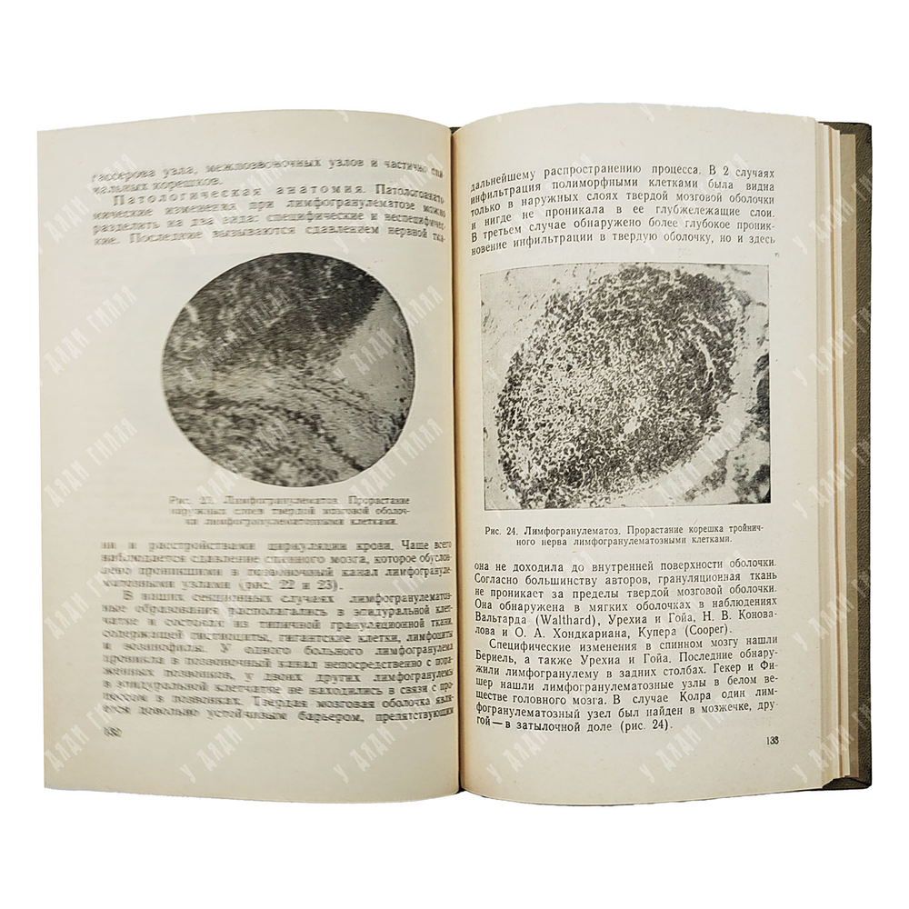 Лурье З. Л. Поражения нервной системы при внутренних болезнях, 1960.