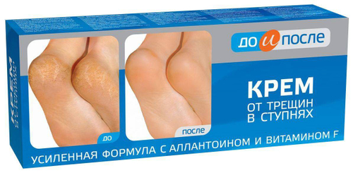 До и После Крем от трещин в ступнях 50 мл
