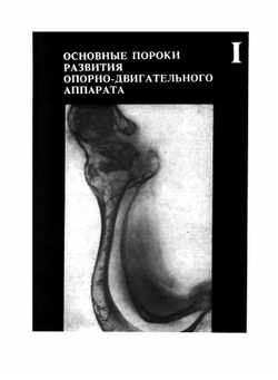 Рентгенодиагностический атлас. Том 1. Болезни опорно-двигательного аппарата | А.В. Руцкий
