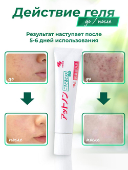 Attonon Medicated Acne Essence