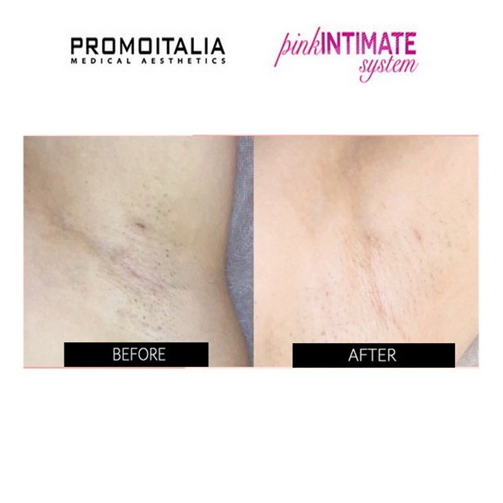 Қысқа юбкадағы азиялық әйел порно