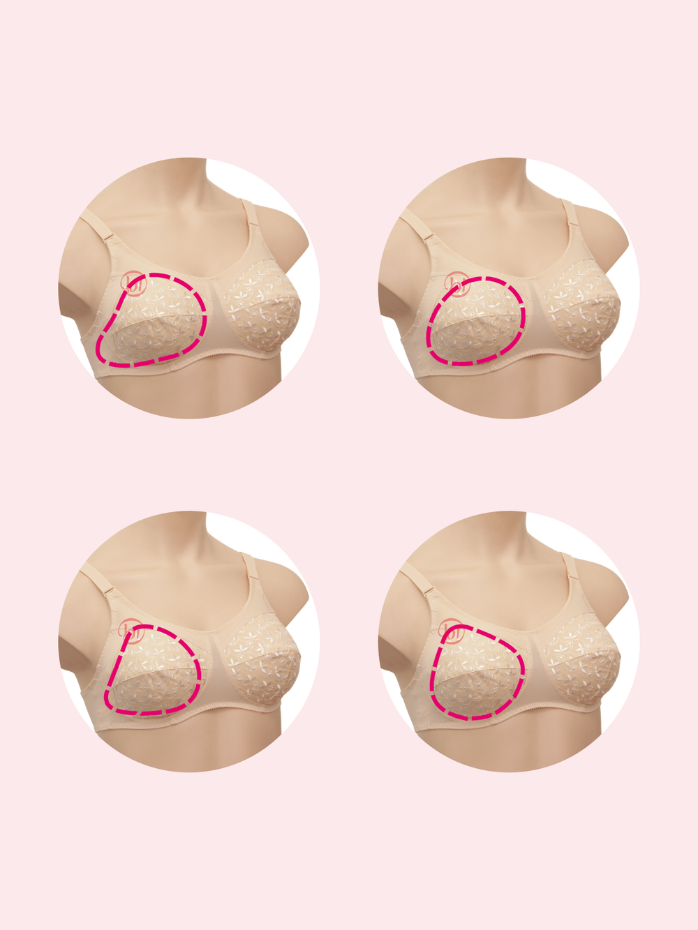 Бюстгальтер для фиксации экзопротеза молочной железы Valeria ЛФ Белый 70