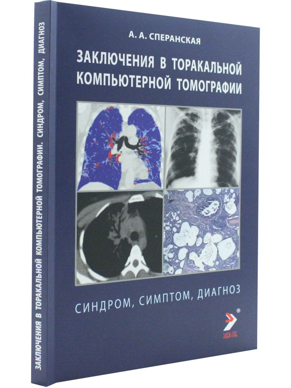 Заключение в торакальной компьютерной томографии. Симптом, синдром, диагноз
