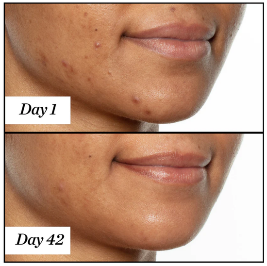 Sunday Riley UFO Очищающее масло для лица с 1,5% салициловой кислотой