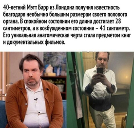 "Размер не главное: как 30 см 'достоинства' сломали мужчине руку