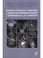 Магнитно-резонансная томография в диагностике приращения плаценты у беременных во II и III триместрах