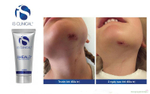 Is clinical SHEALD™ Recovery Balm 15 мл Бальзам защитный восстанавливающий -
