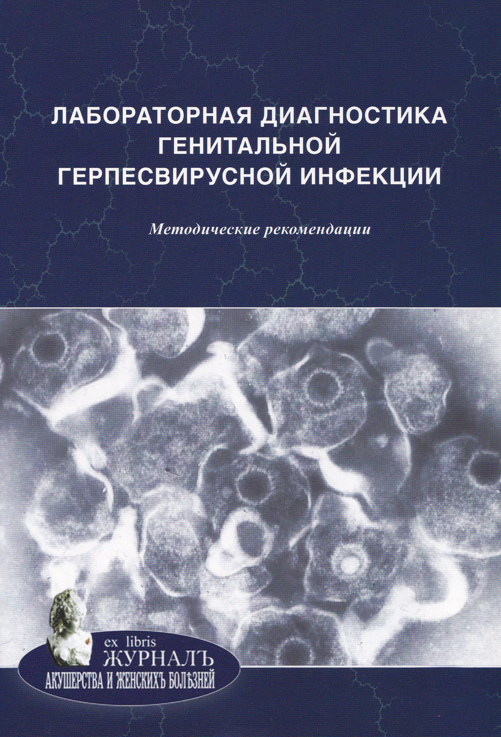 Лабораторная диагностика генитальной герпесвирусной инфекции: методические рекомендации