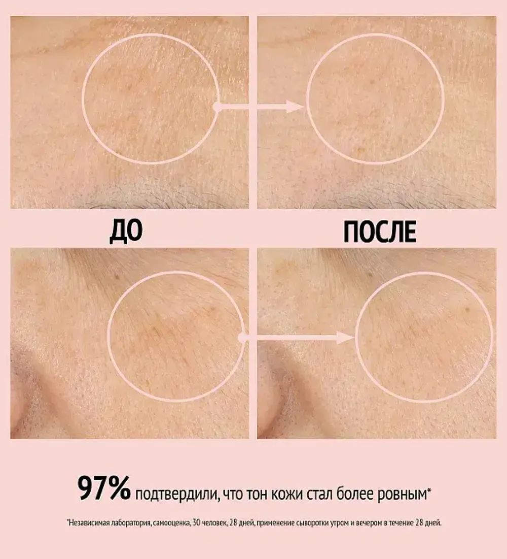 COMFORT ZONE LUMINANT SERUM Сыворотка-корректор против пигментных пятен