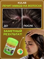 Тайская мазь от грибка ногтей, микоза и трещин на пятках