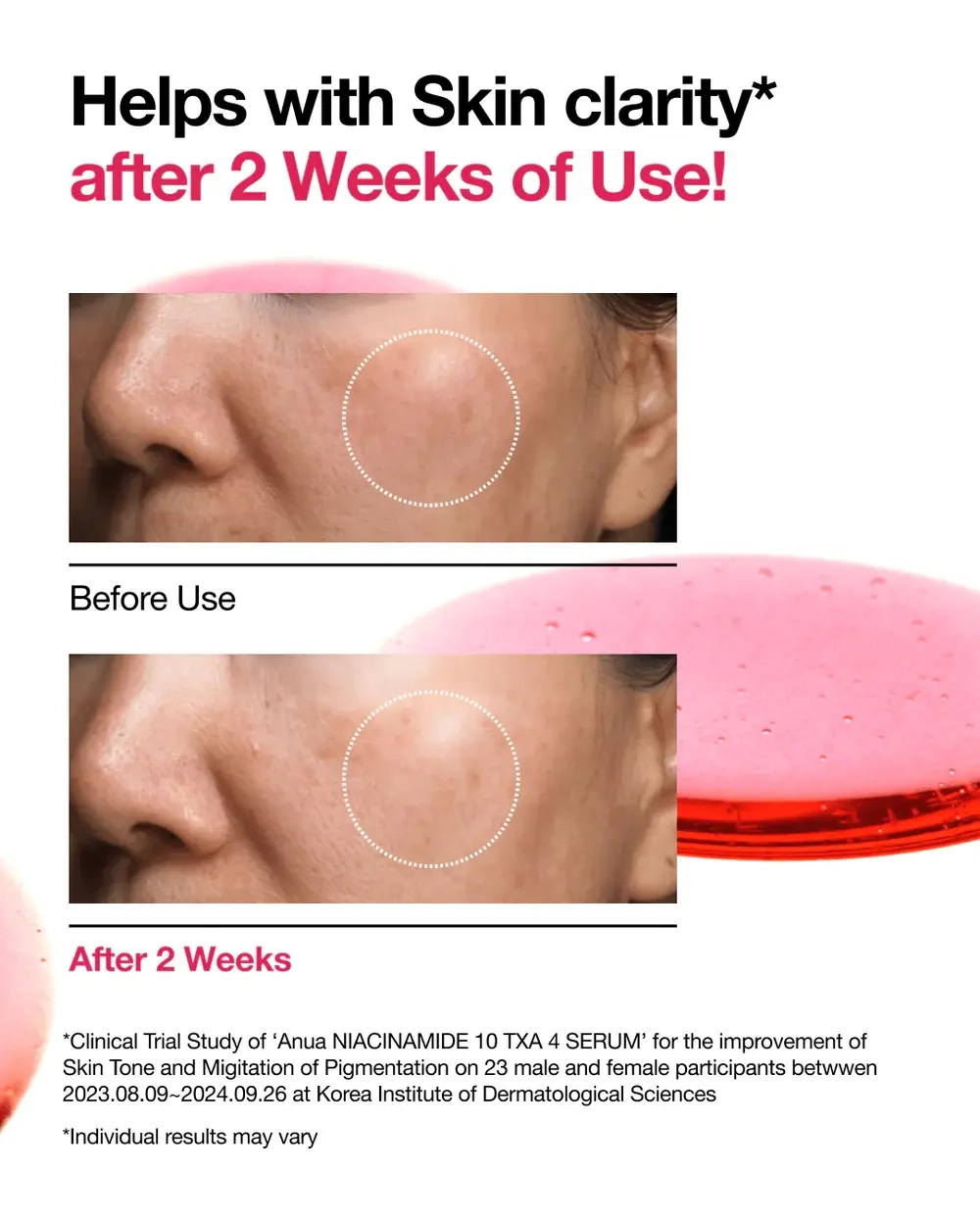 Сыворотка для лица Anua Niacinamide 10% + TXA 4% Serum 30 мл