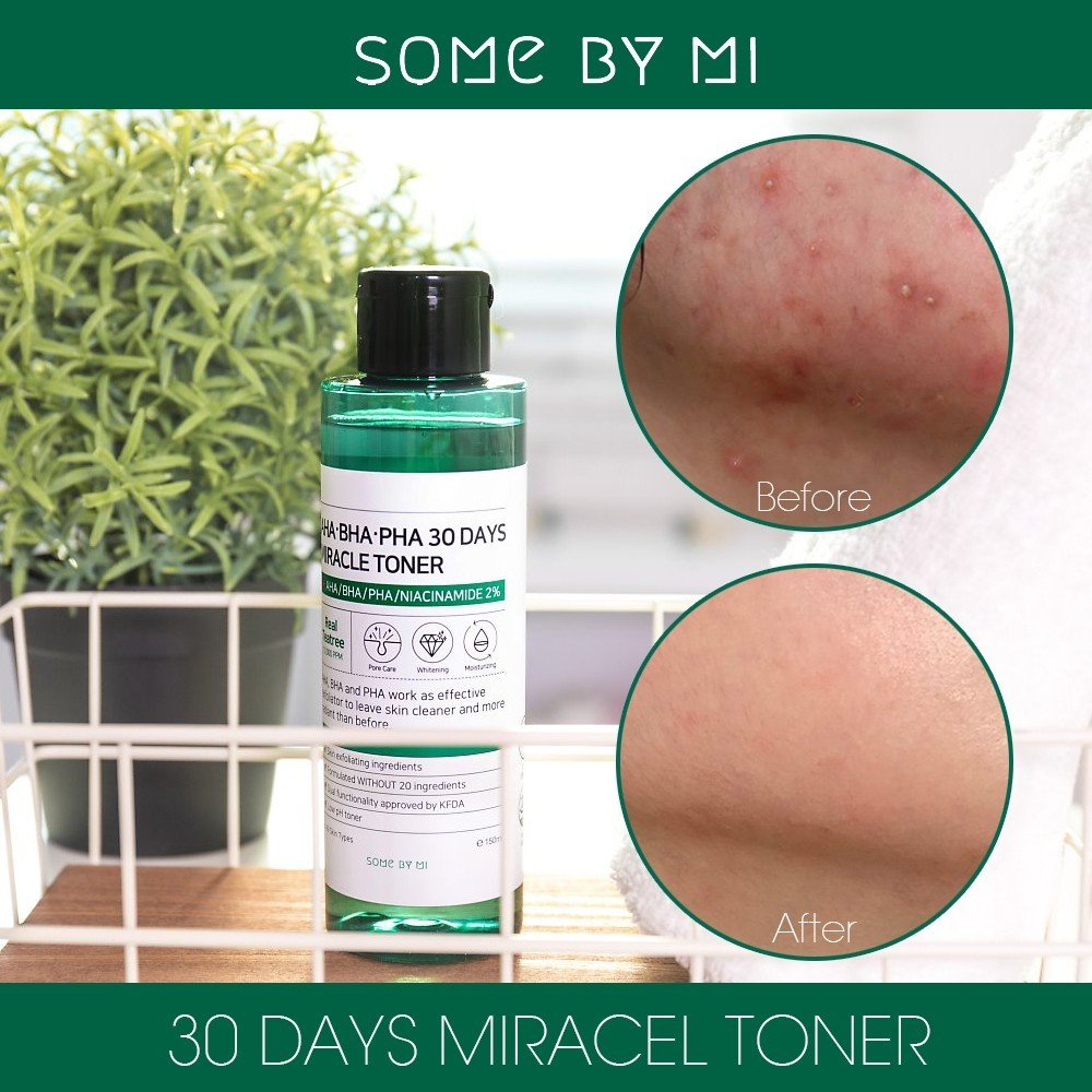 Some By Mi AHA-BHA-PHA 30 Days Miracle Toner кислотный очищающий тонер для проблемной кожи