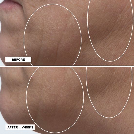 Увлажняющий крем Perricone MD High Potency Classics: Hyaluronic Intensive Moisturizer