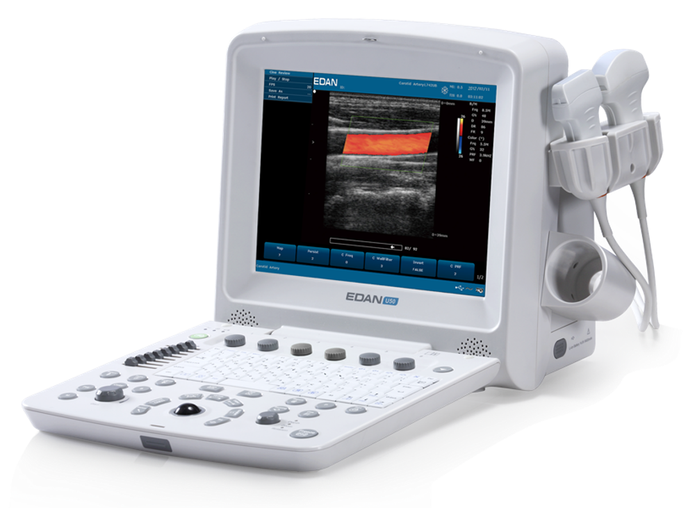 УЗИ аппарат Edan U50 Prime Edition