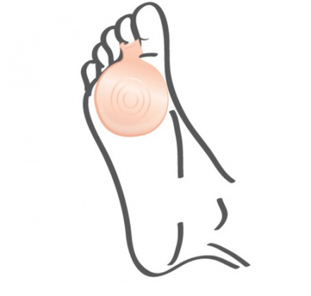 Подушечки ортопедические для стоп