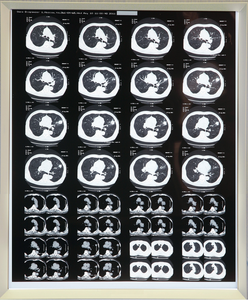 Негатоскоп на 1 снимок медицинский светодиодный