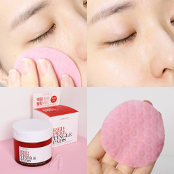So Natural Red Peel Tingle Pad кислотные пады с тингл- эффектом