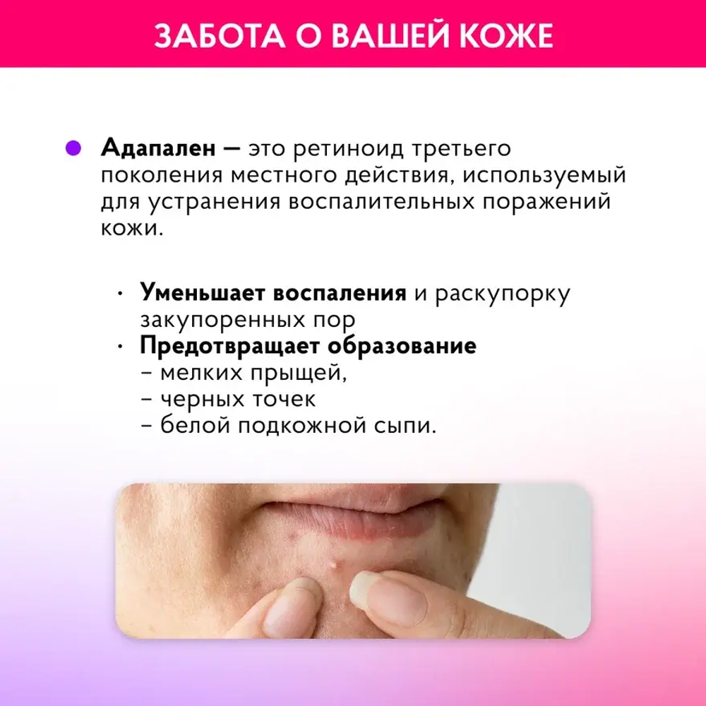 Набор №1 для легкой степени акне (комедональной)