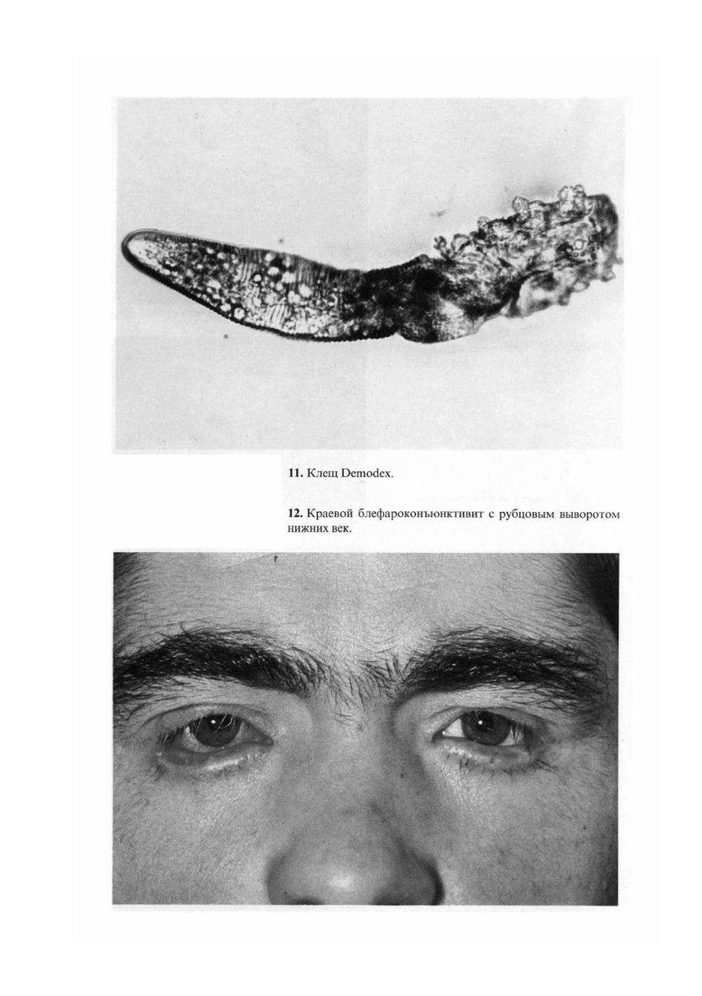 Атлас глазных болезней | Н.А. Пучковская