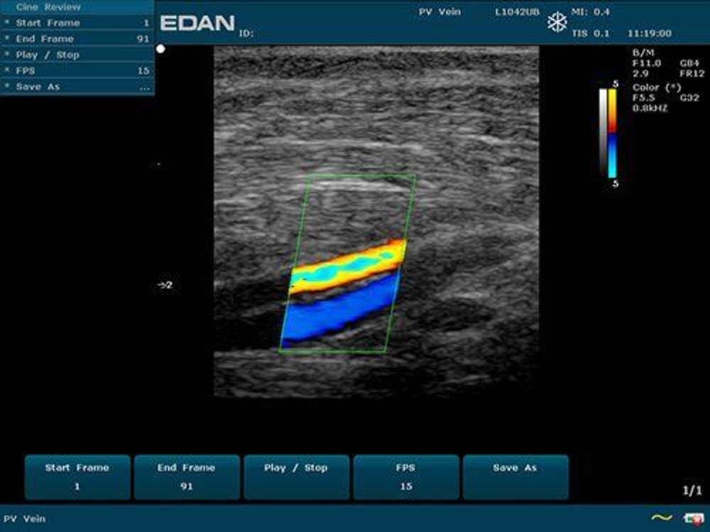 Аппарат УЗИ Edan U50 (для педиатрии и кардиологии, стандартный)