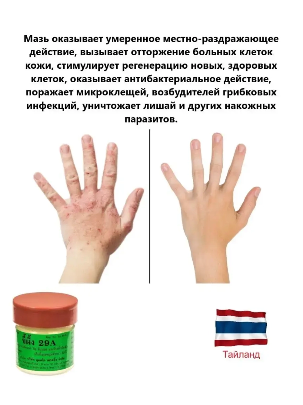 Тайская Мазь 29А от псориаза, грибка и дерматита